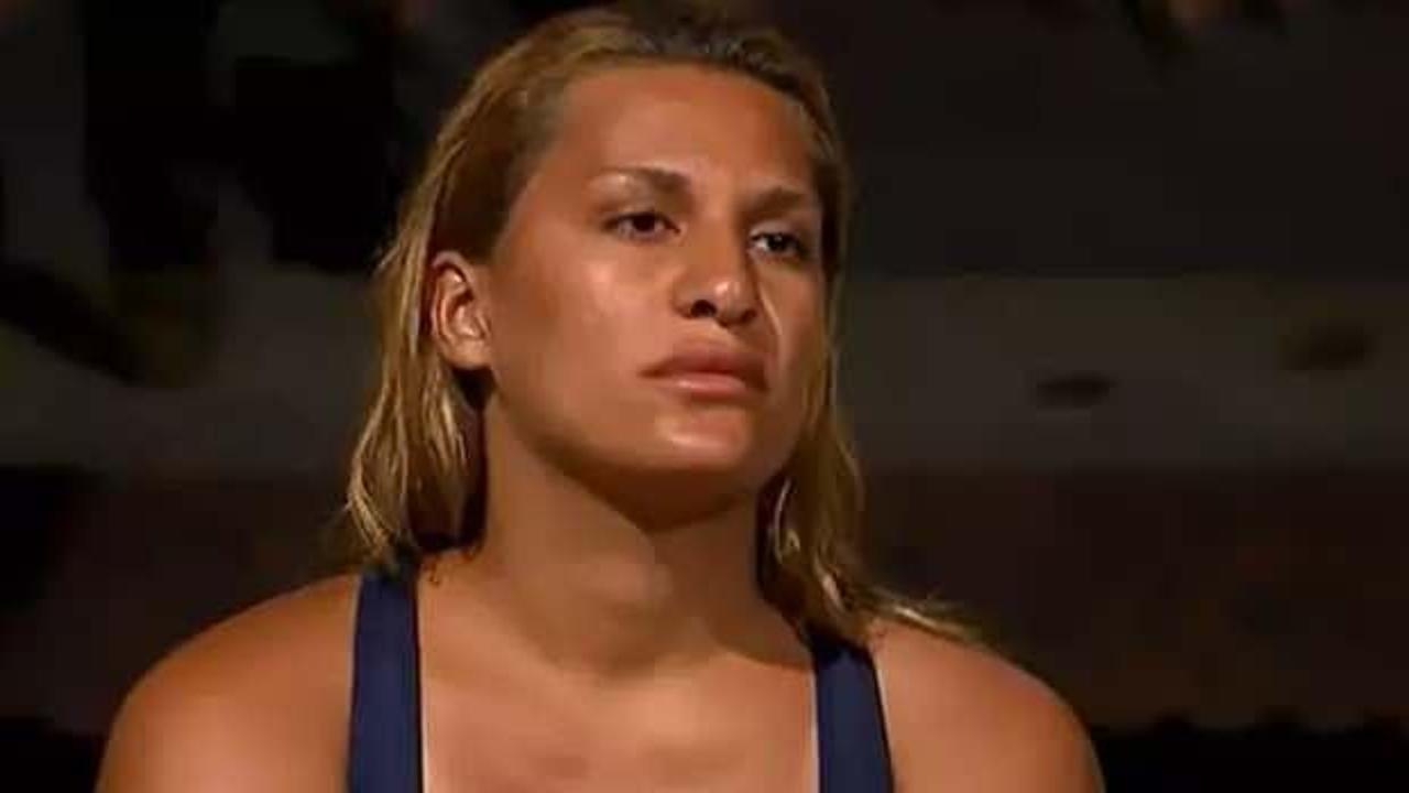 Survivor'dan sonra bıçak altına yatmıştı! Almeda'nın son hali hayrete düşürdü