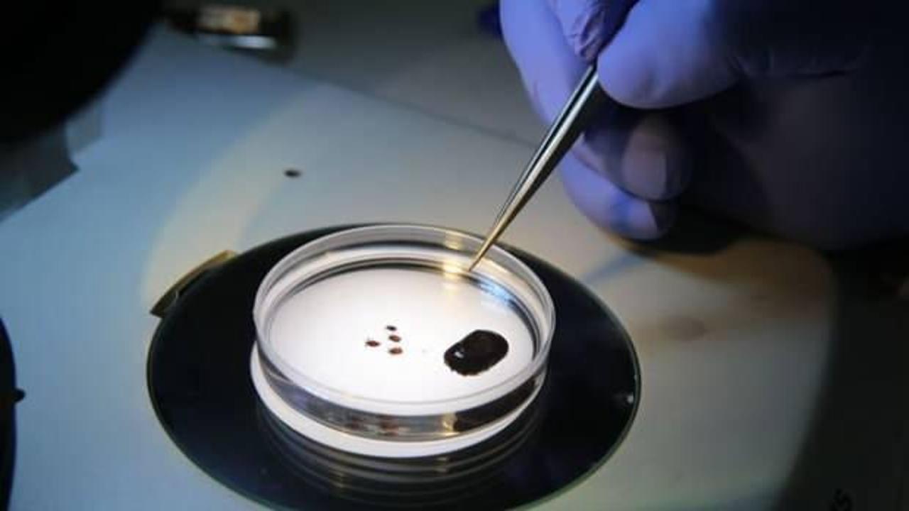 Uzmanlardan hayati uyarı! Ölümcül tehlike toplu iğne büyüklüğünde