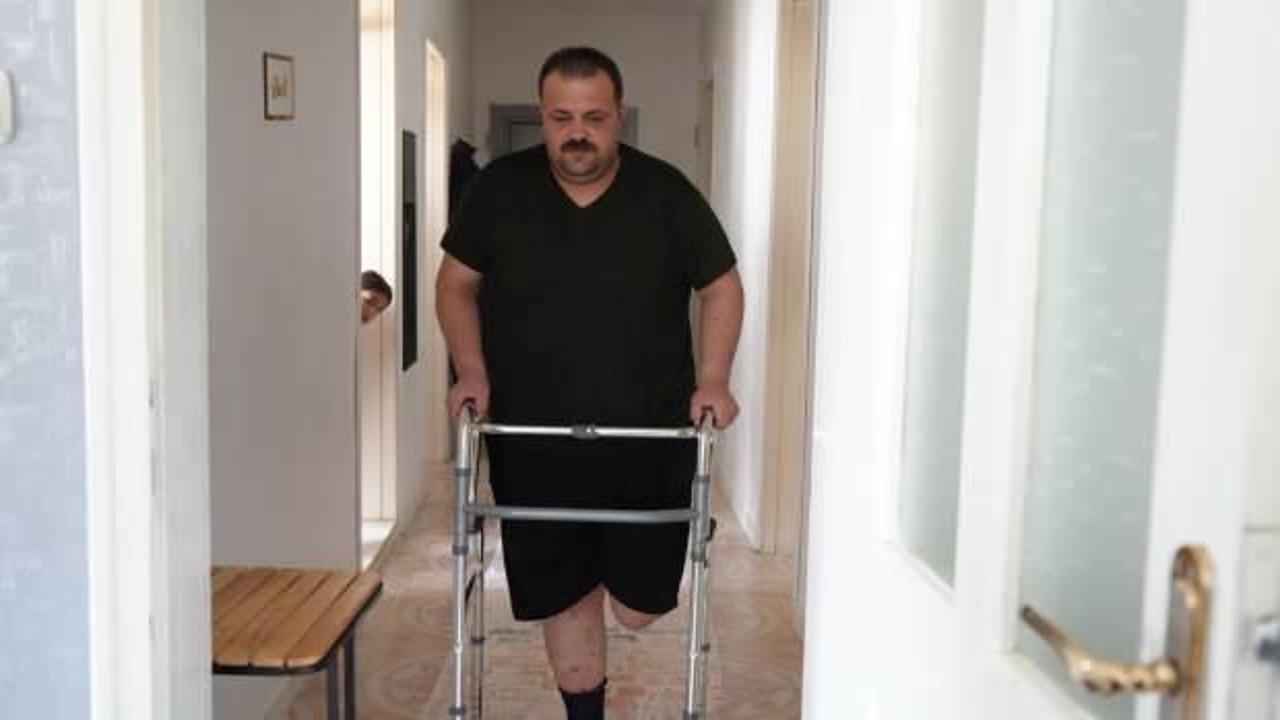 Yanlış tedavi iddiası: Bel ağrısı ile gitti, bacağından oldu!