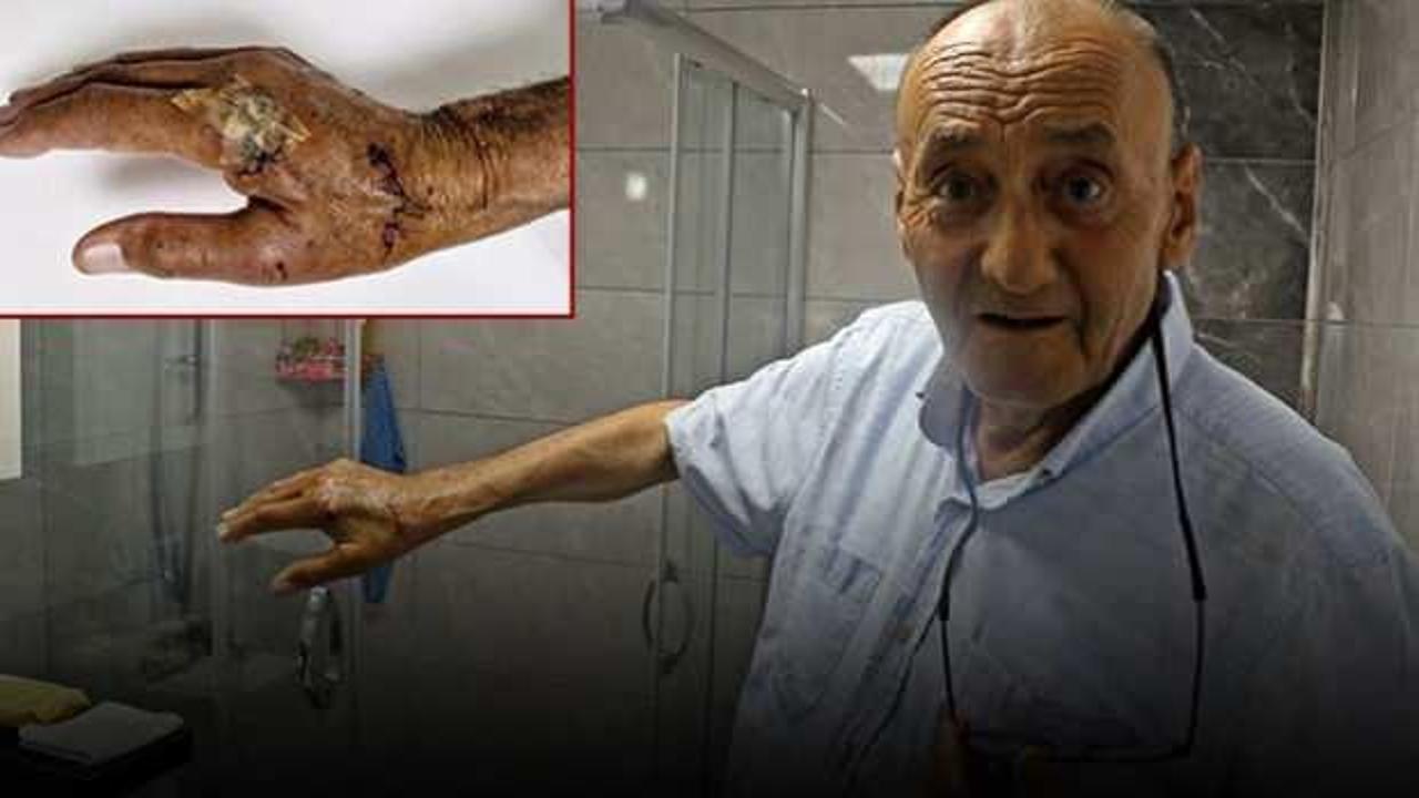 Banyoda kabusu yaşadı: Kanlar i&ccedil;inde kaldı! Dolu yağar gibi...