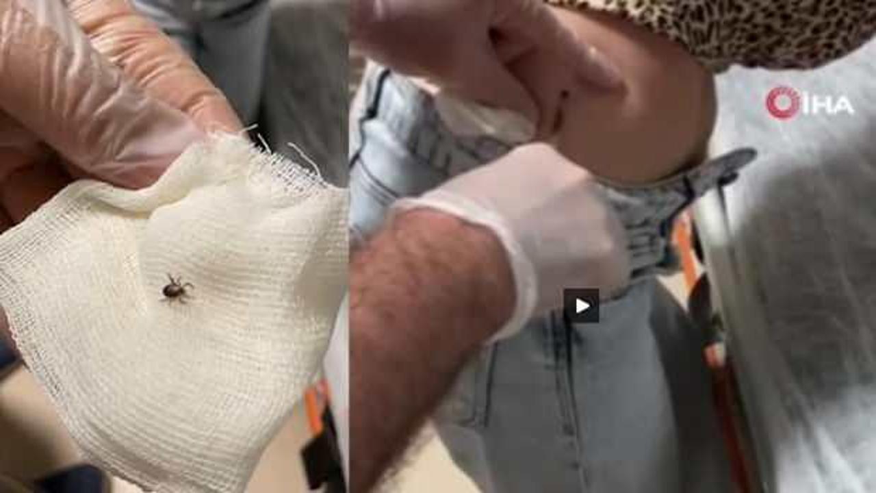 Kene kabusu Eskişehir'e sıçradı: Sırtına kene yapışan kadın hastanelik oldu