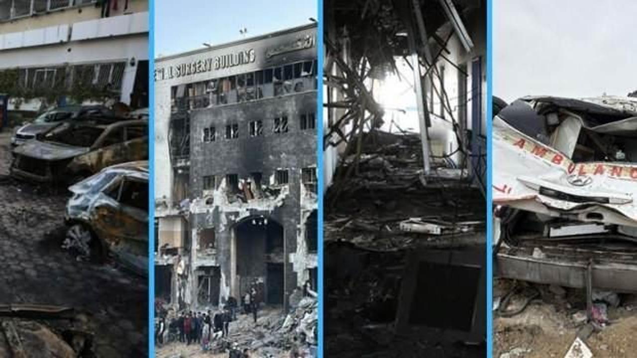 İşte İsrail'in Gazze'de sicili! Sağlık sistemi adeta yok edildi