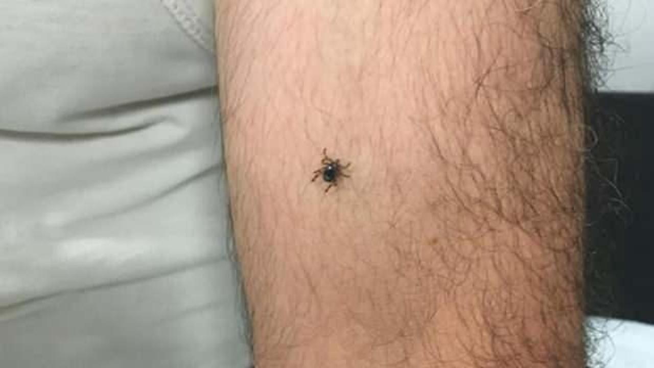 Kâbus devam ediyor: Kayseri’nin bir ilçesinde daha kene vakası görüldü