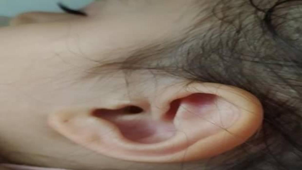 Parkta 3 yaşındaki çocuğun kulağına kene yapıştı