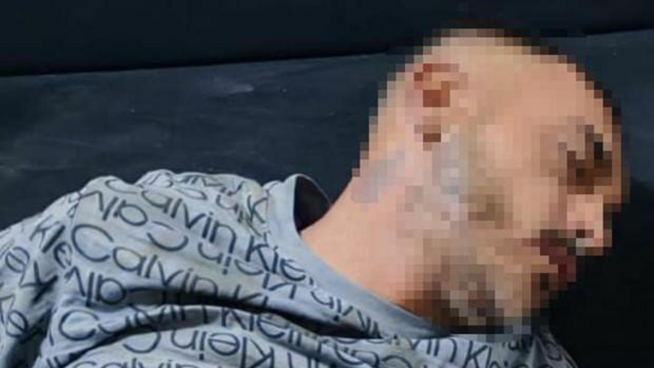 KADES ihbarına giden polisi bıçaklayan şahıs vurularak yakalandı