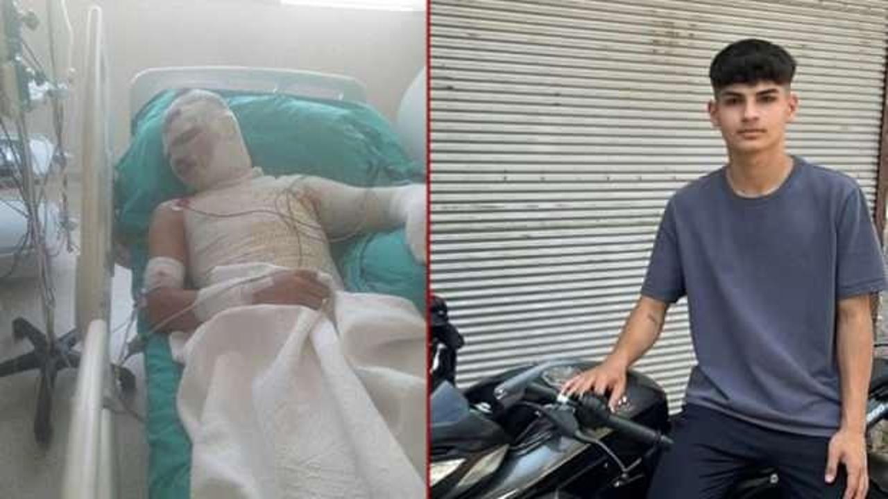 Korkunç olay: 16 yaşındaki yeğenini üzerine benzin dökerek yaktı