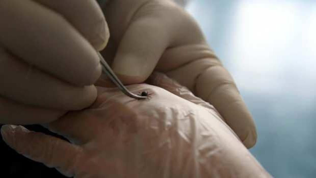 Tokat'ta, 3'ü çocuk 5 kişi KKKA hastalığı teşhisiyle tedavi görüyor 