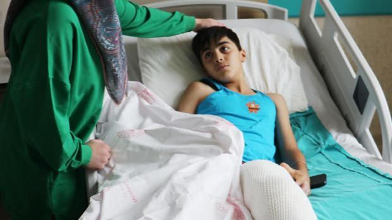 Şaka yaparken arkadaşını kolonya ile yaktı!