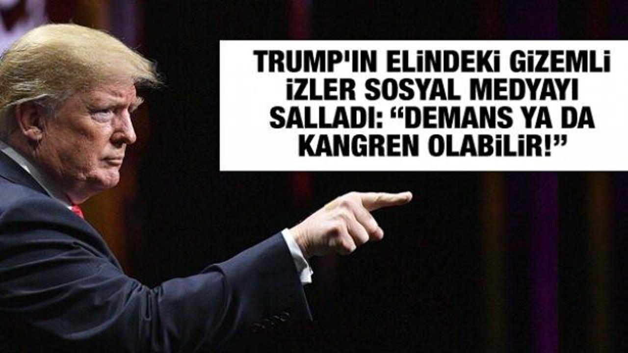 Trump'ın elindeki gizemli izler sosyal medyayı salladı: “Demans ya da kangren olabilir!”