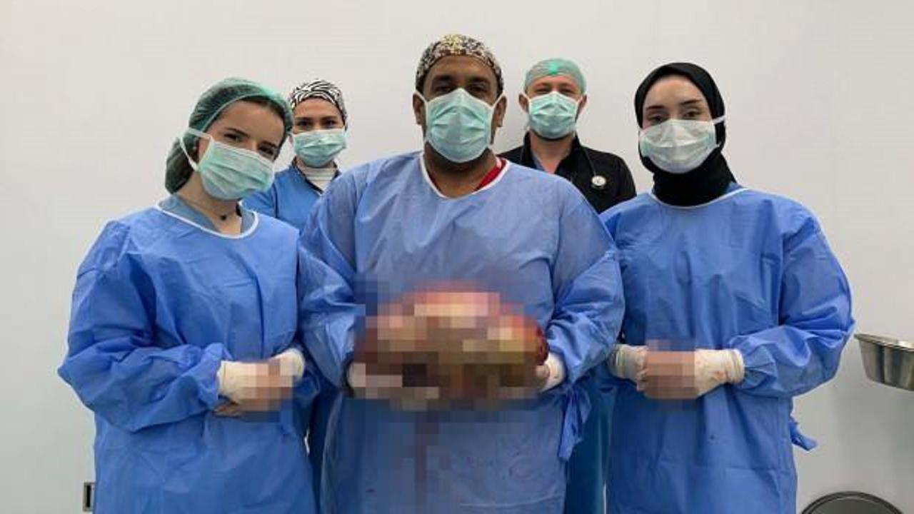 Şişlik yüzünden gittiği hastanede karnından 10 kilogram ağırlığında kitle çıkarıldı 
