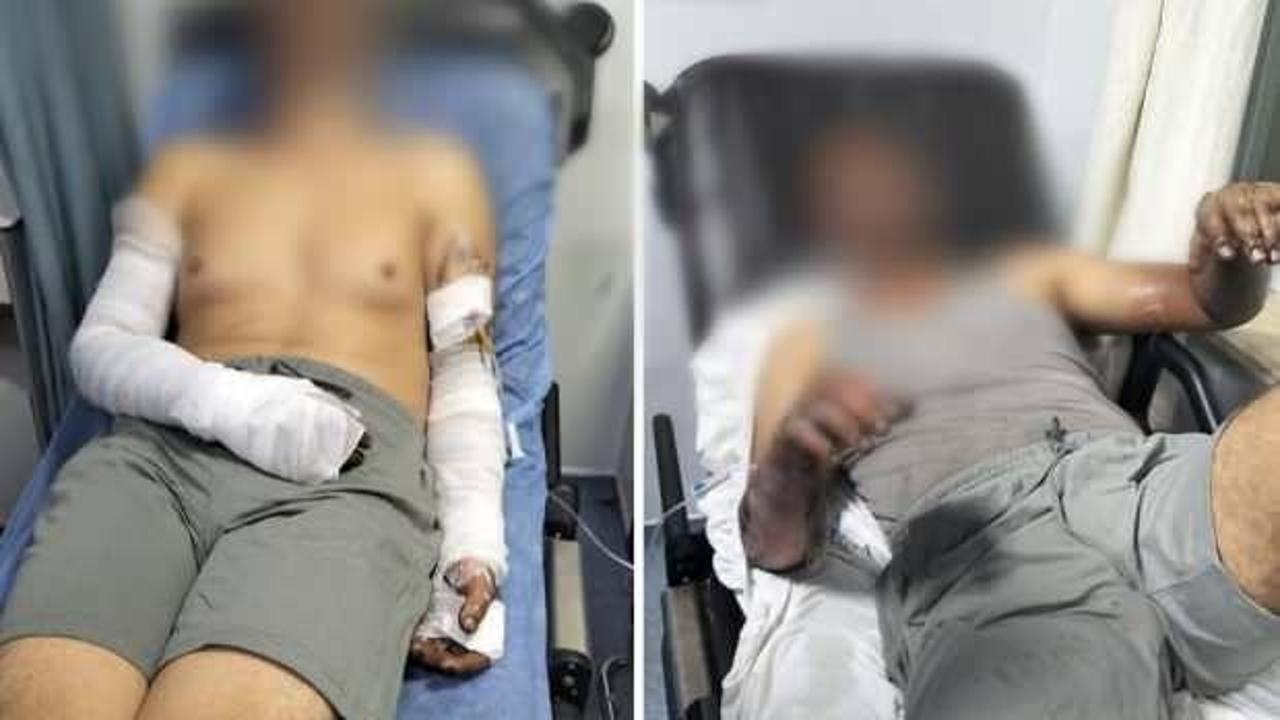  Manisa'da sanayi sitesinde korkutan patlama: Yaralılar var!