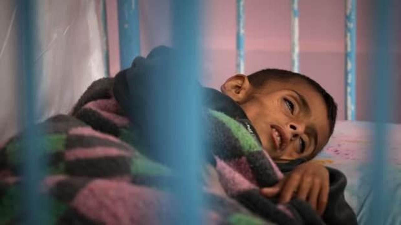 Gazze'de açlıktan vefat edenlerin sayısı 197'ye çıktı