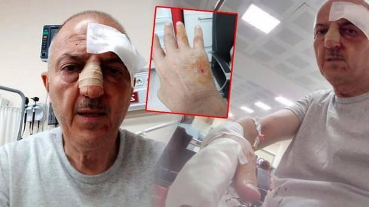 Önce icra yoluyla evinden tahliye edildi, ardından darp edildi