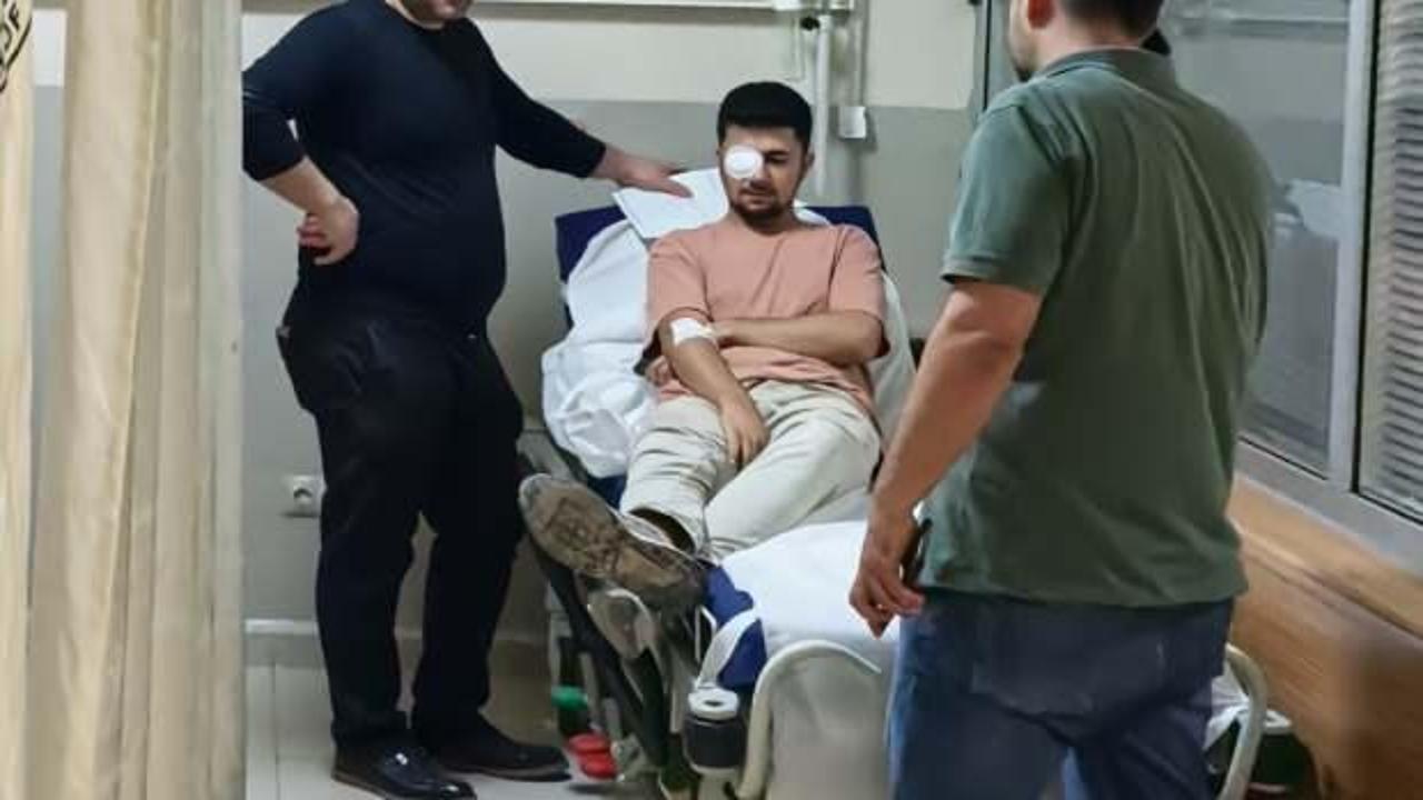 Fabrikada feci kaza: Gözüne çivi saplandı!