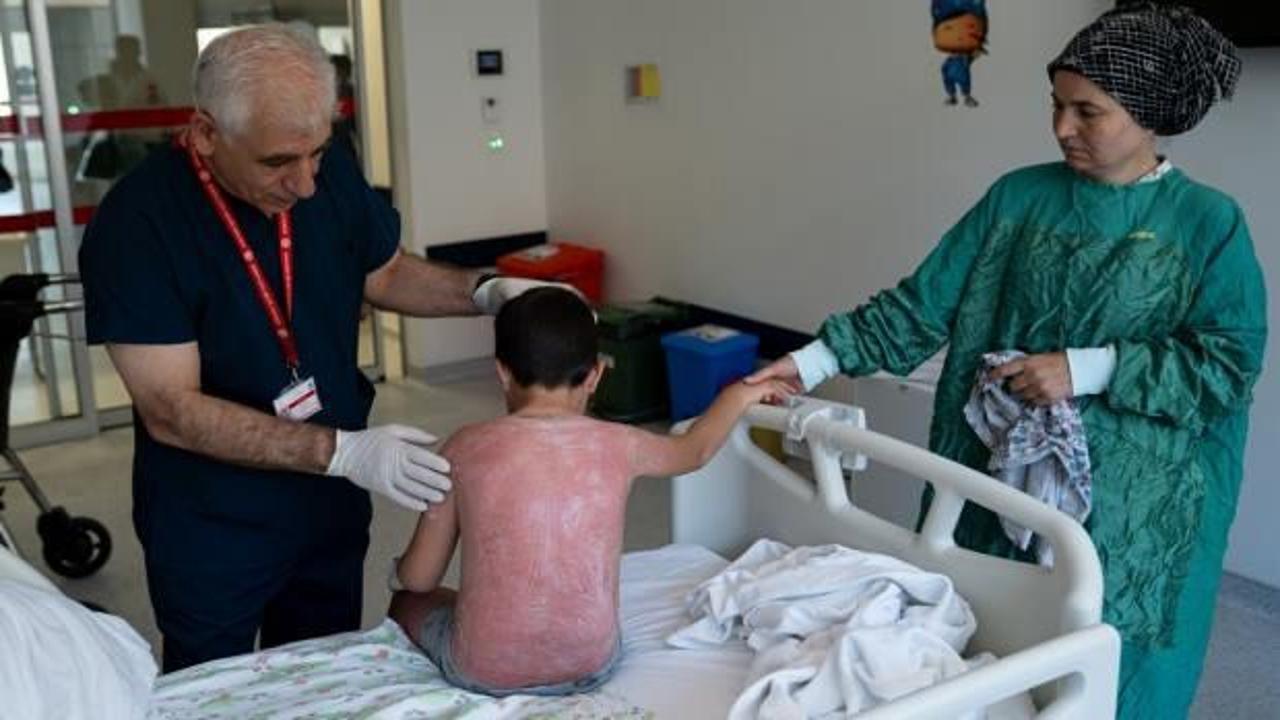 Tatilleri kâbusa döndü! 4 saat güneşte kalan çocuk, hastanelik oldu