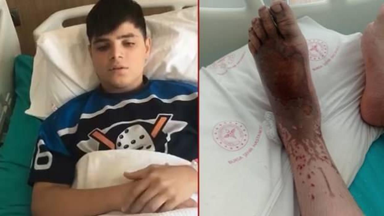 14 yaşındaki Turan, asit &ccedil;amuruna bastı! Korkun&ccedil; iddia...