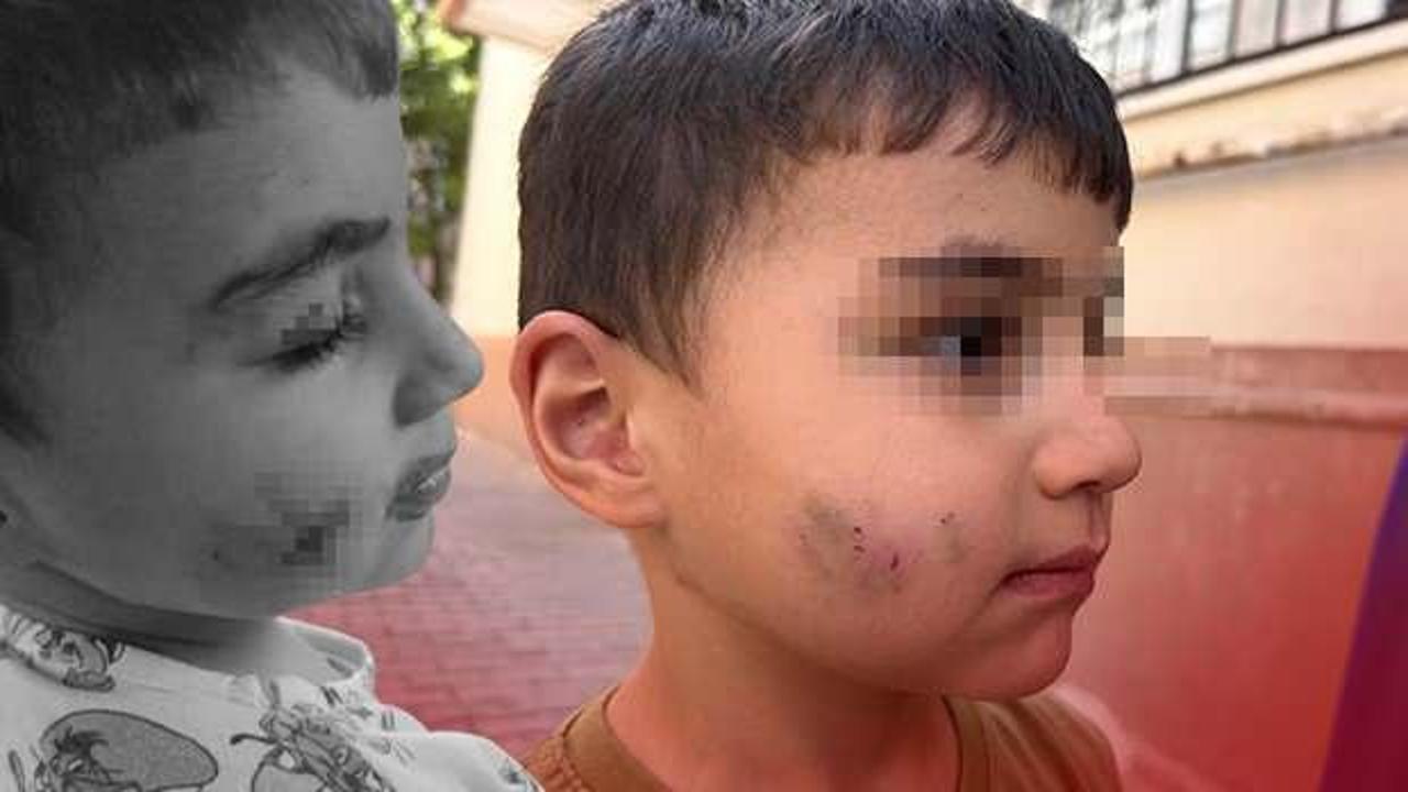 Uyurken dehşeti yaşadı: Lağım faresi ısıran çocuğa kuduz aşısı yapıldı!