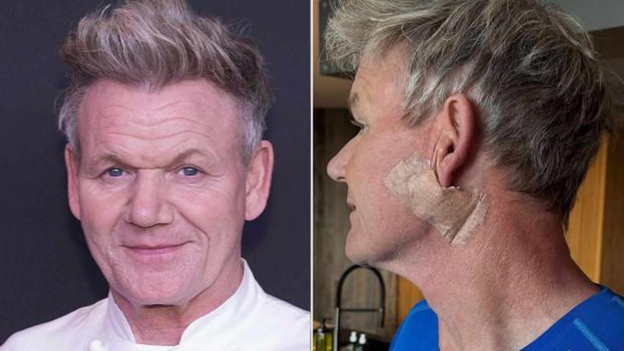 Gordon Ramsay kansere yakalandı