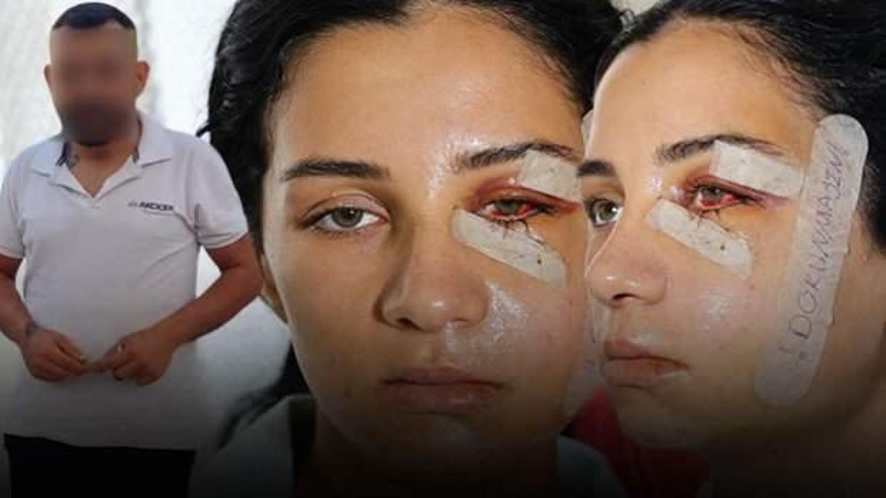 Eski kocası tarafından darbedilen Ganime, yaşadığı dehşeti anlattı