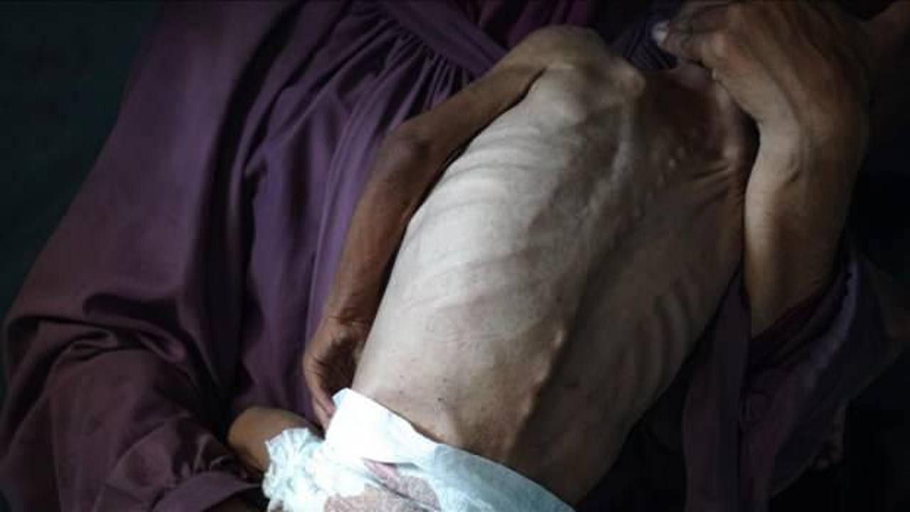 Gazze'de son 1 günde 1'i çocuk 6 kişi daha açlıktan şehit oldu