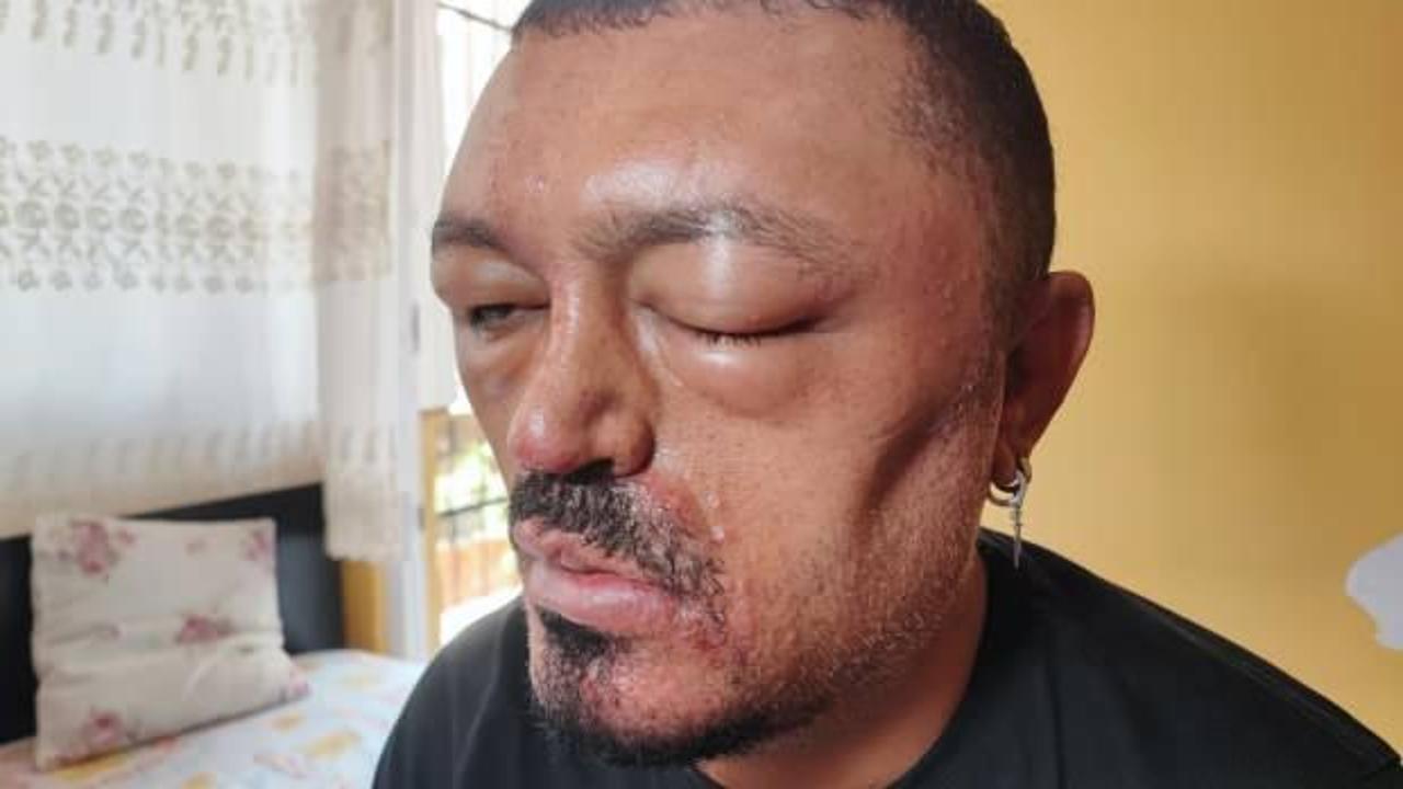 Yer: Adana! Saçlarını siyahlaştırmak için satın aldığı şampuan kâbusu oldu