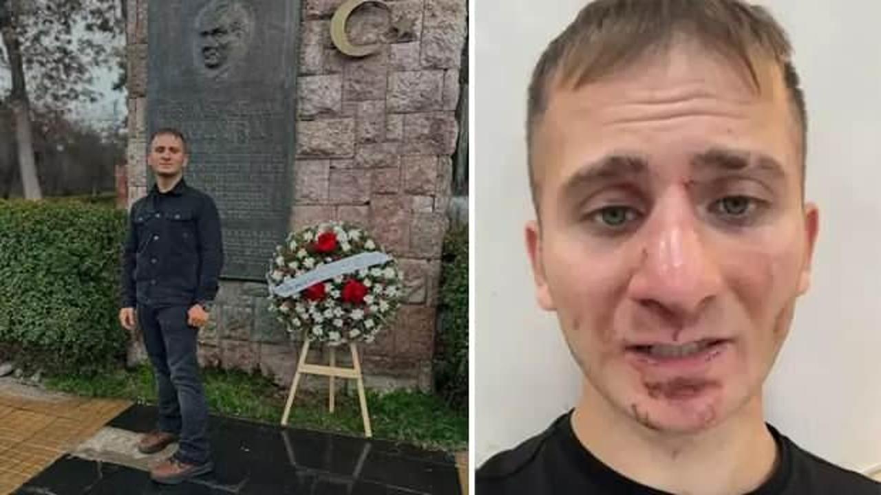 T&uuml;rk vatandaşı Ekvador'da saldırıya uğramıştı! B&uuml;y&uuml;kel&ccedil;ilik temas halinde