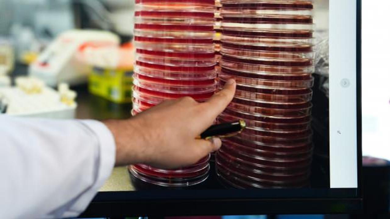 Uzayda göz sağlığına Türk katkısı