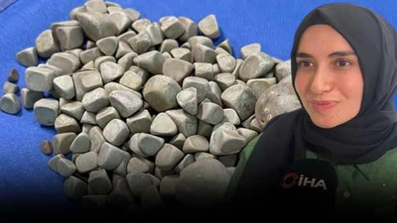 Doktorları şoke eden vaka! Vücudundan 287 tane taş çıkarıldı