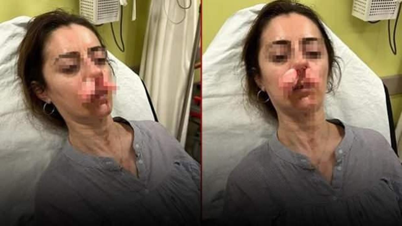 Edirne'de akılalmaz olay! Otomobil kapısı silah sayıldı 