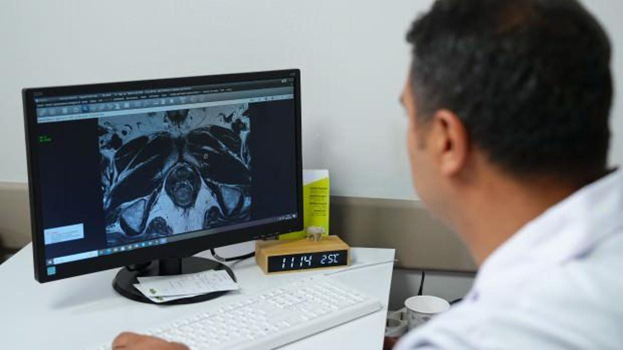 Prostat kanserinde erken ve doğru tanı için "Füzyon biyopsi" dönemi