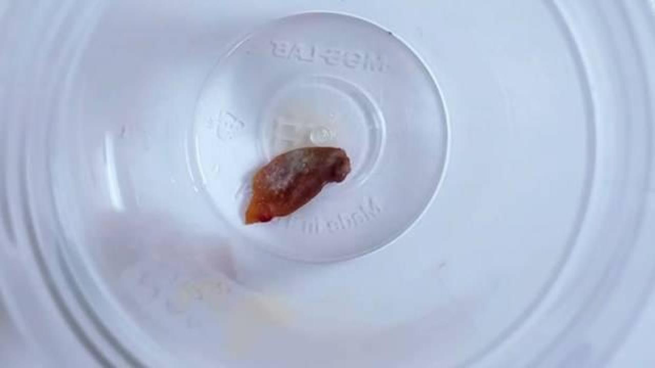 1,5 yıllık &ouml;ks&uuml;r&uuml;ğ&uuml;n sebebi, kabak &ccedil;ekirdeği &ccedil;ıktı