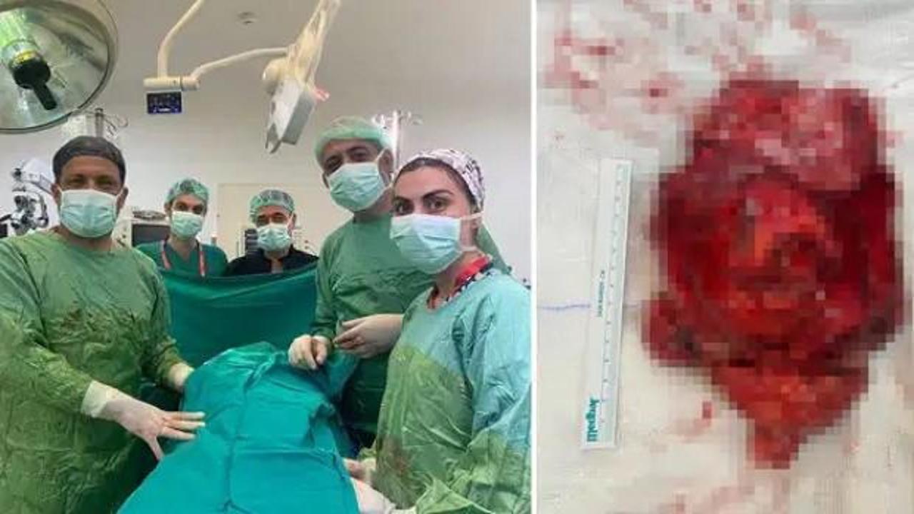 2.5 milyonda bir görülüyor, tam 1,1 kg!