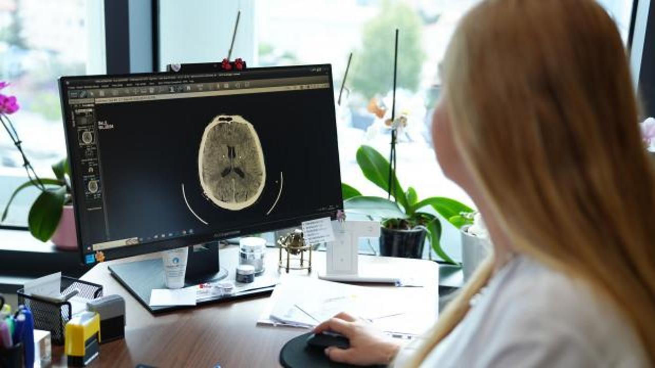 Uykusuzluk ve alkol küme baş ağrılarını tetikleyebilir