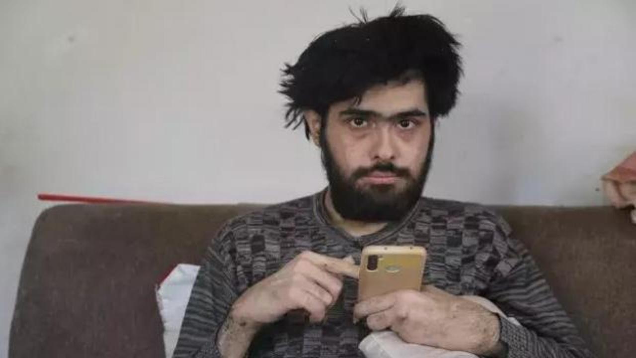 Türkiye'nin konuştuğu ve 3 yıldır tırnaklarını kesmeyen gencin eski hali ortaya çıktı