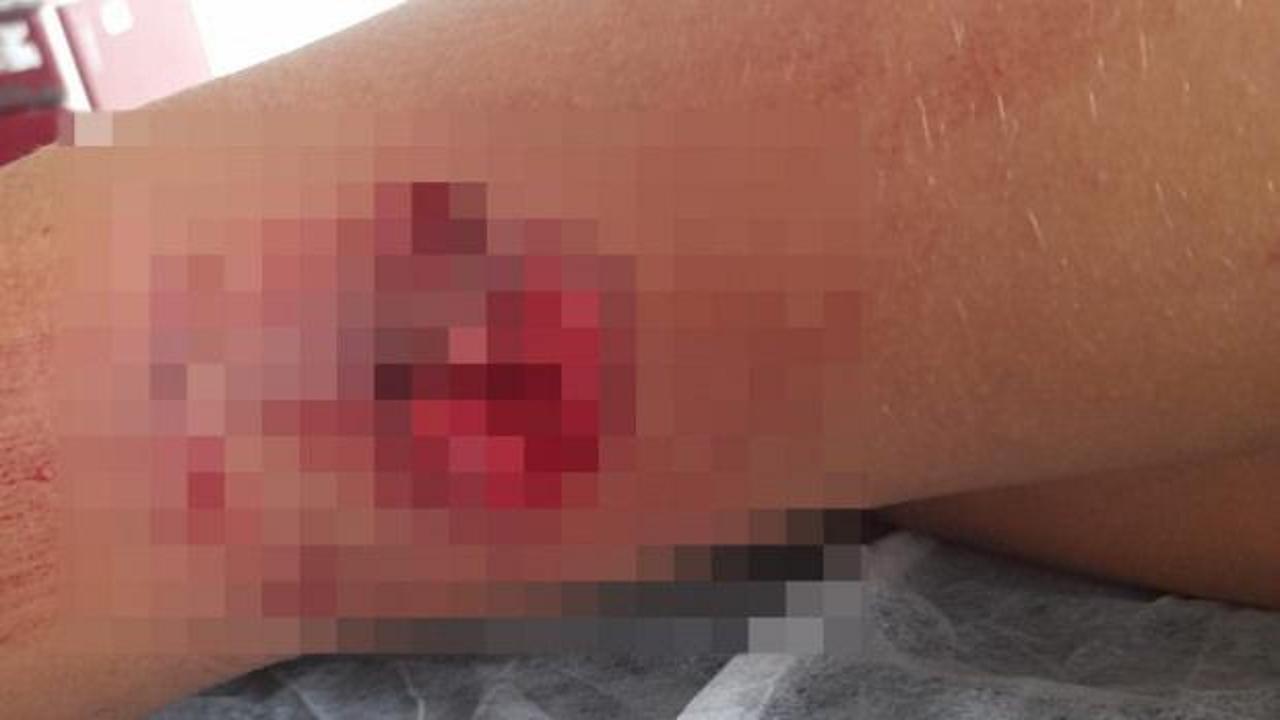 Yer: Bursa! Bir çocuk daha başıboş köpek tarafından parçalandı