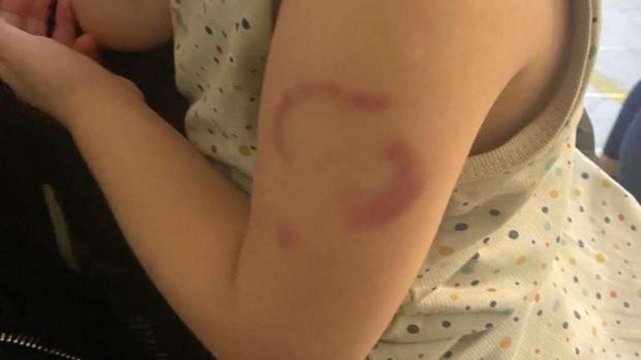 Öğrencisinin kolunu ısırdığı iddia edilen öğretmenin savunması ortaya çıktı 