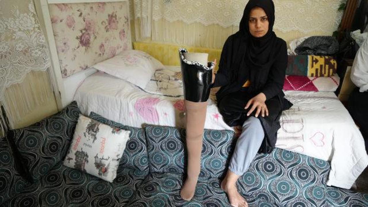 Depremde bacağını kaybeden kadın kocası tarafından terk edildiğini iddia etti