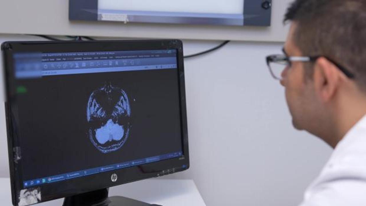 İnme, her yaşta g&ouml;r&uuml;lebilir: İlk 24 saat hayati &ouml;nem taşıyor