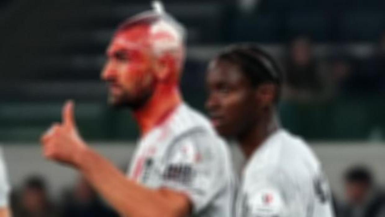 Sahada kanlar içinde kaldı! Formasını değişip maça devam etti