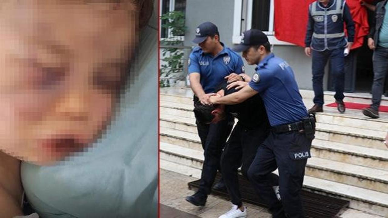 2 yaşındaki bebeği darbederek hastanelik etmişlerdi! Anne hakkında gelişme 