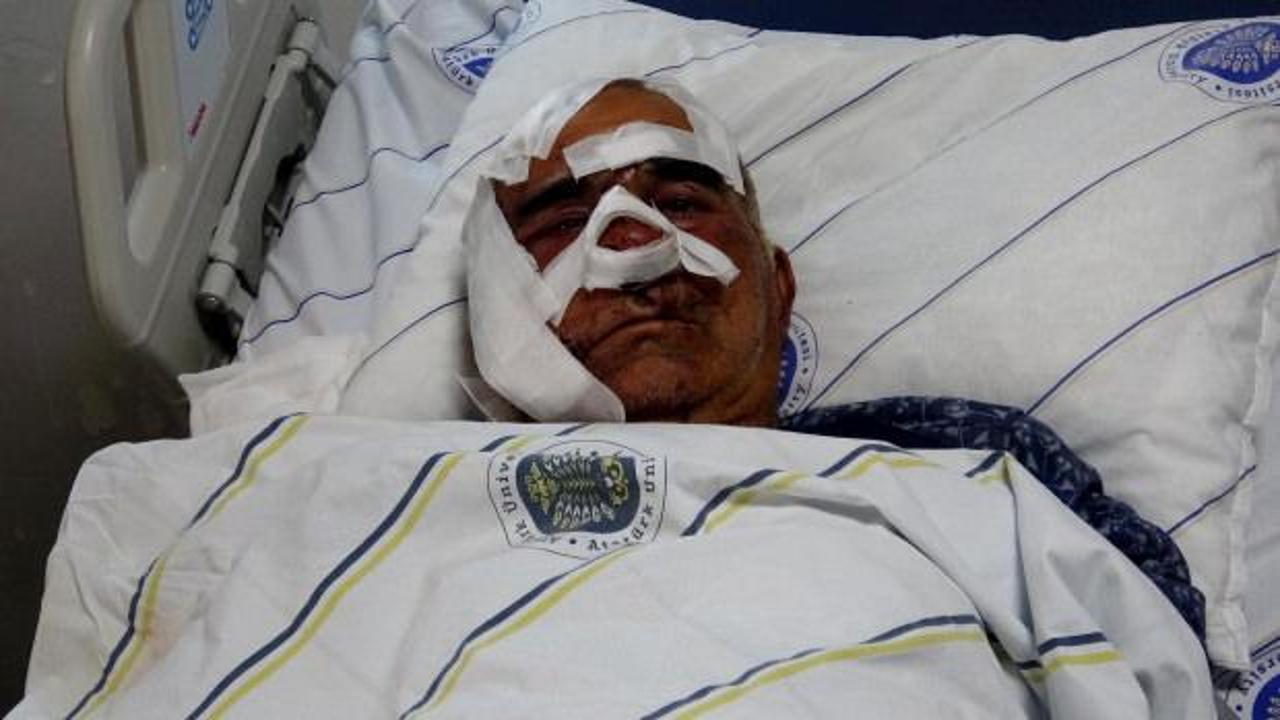 Hayvan otlatırken ayı saldırısına uğradı: Elmacık kemiği koptu! 