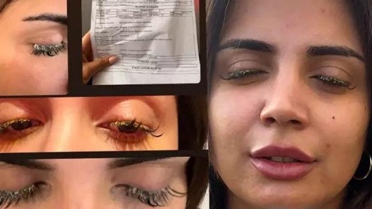 Kirpik yaptırmak isteyen kadının hayatı kabusa d&ouml;nd&uuml;: K&ouml;r olacaktı!