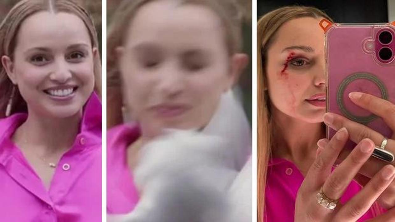 Muhabirin zor anları! Yüzüne kuş çarptı