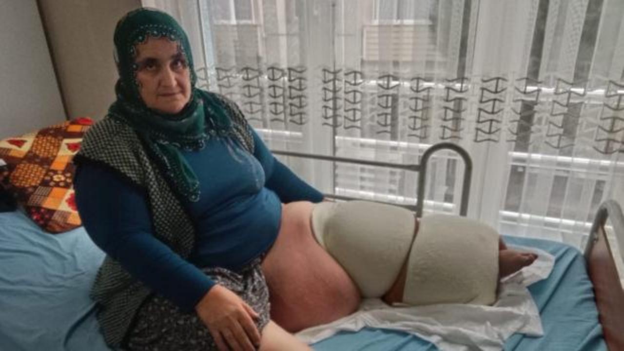Yer: Mersin! 35 yıldır illet hastalıkla mücadele ediyor