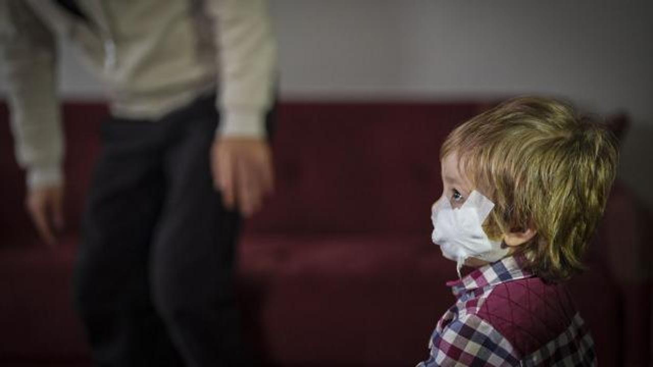 İki kardeş pitbull saldırısına uğramıştı! Efe de taburcu edildi