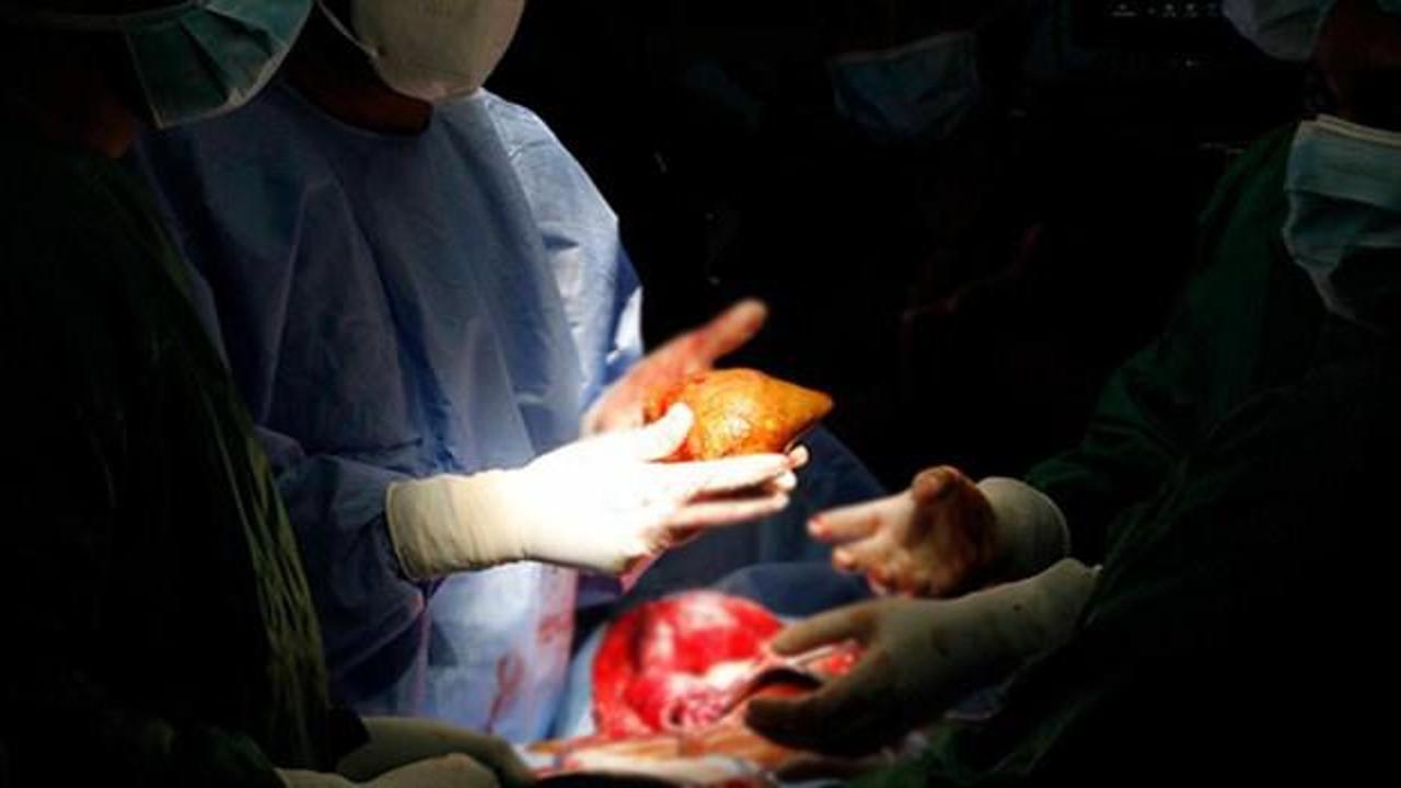 Kuduzlu böbrek nakli yapıldı, hayatını kaybetti