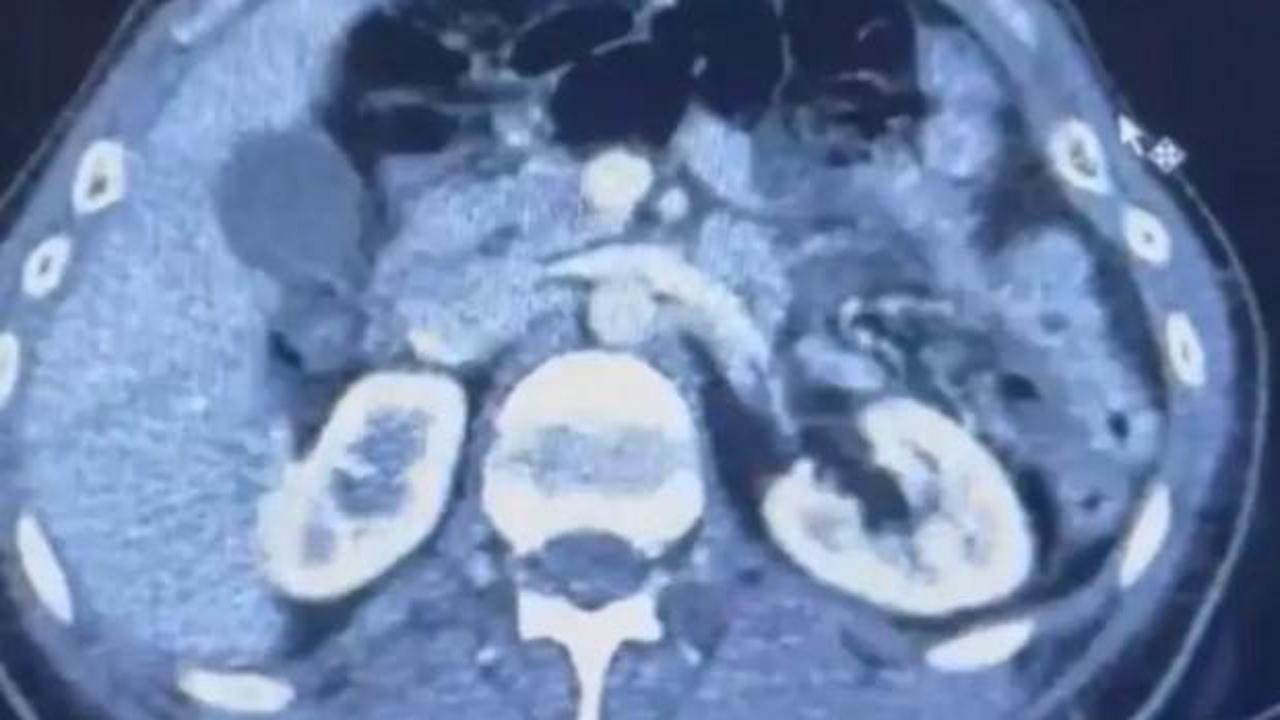 Üç İranlı röntgene girince yakayı ele verdi