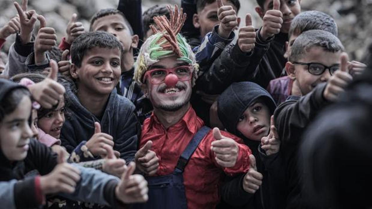 Gazzeli palya&ccedil;o, acısına rağmen &ccedil;ocukları g&uuml;ld&uuml;r&uuml;yor