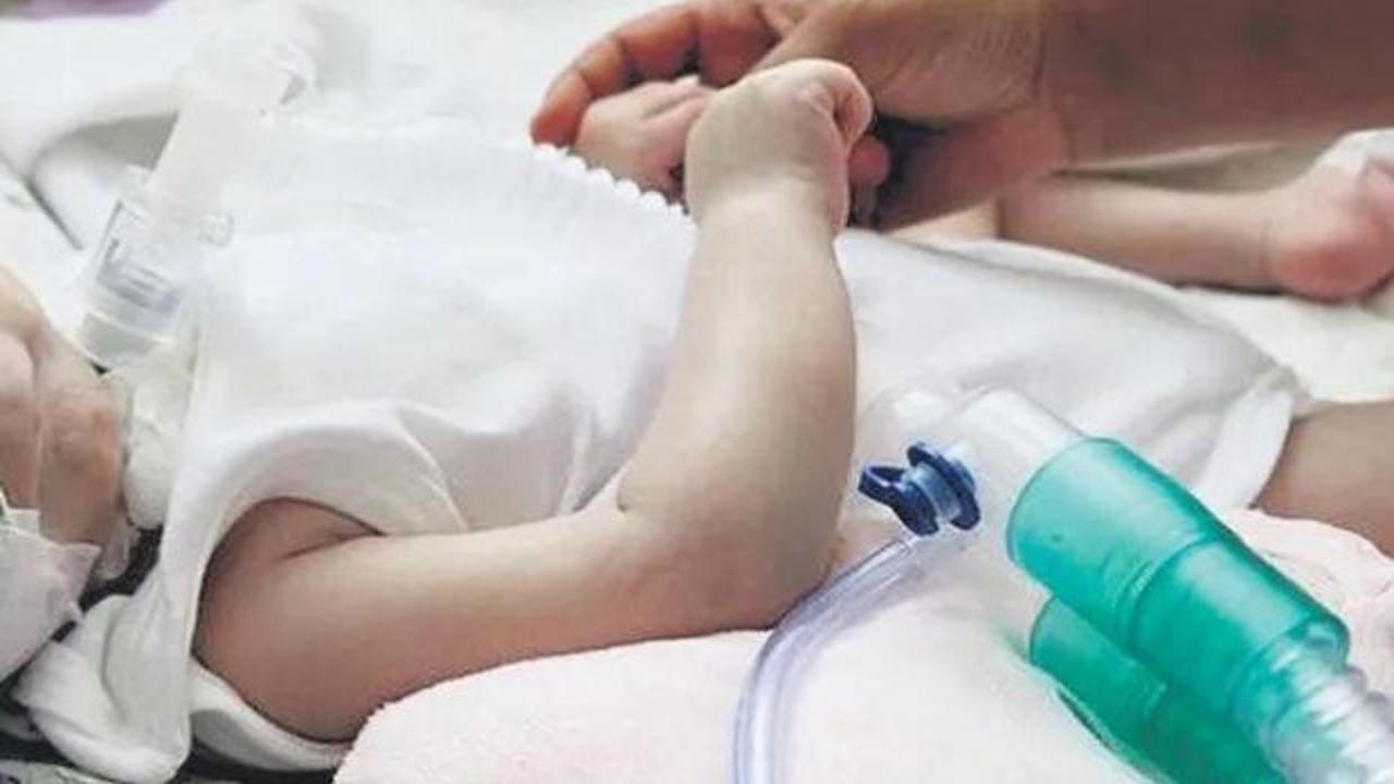 SMA&rsquo;lı hasta sayısı azaldı