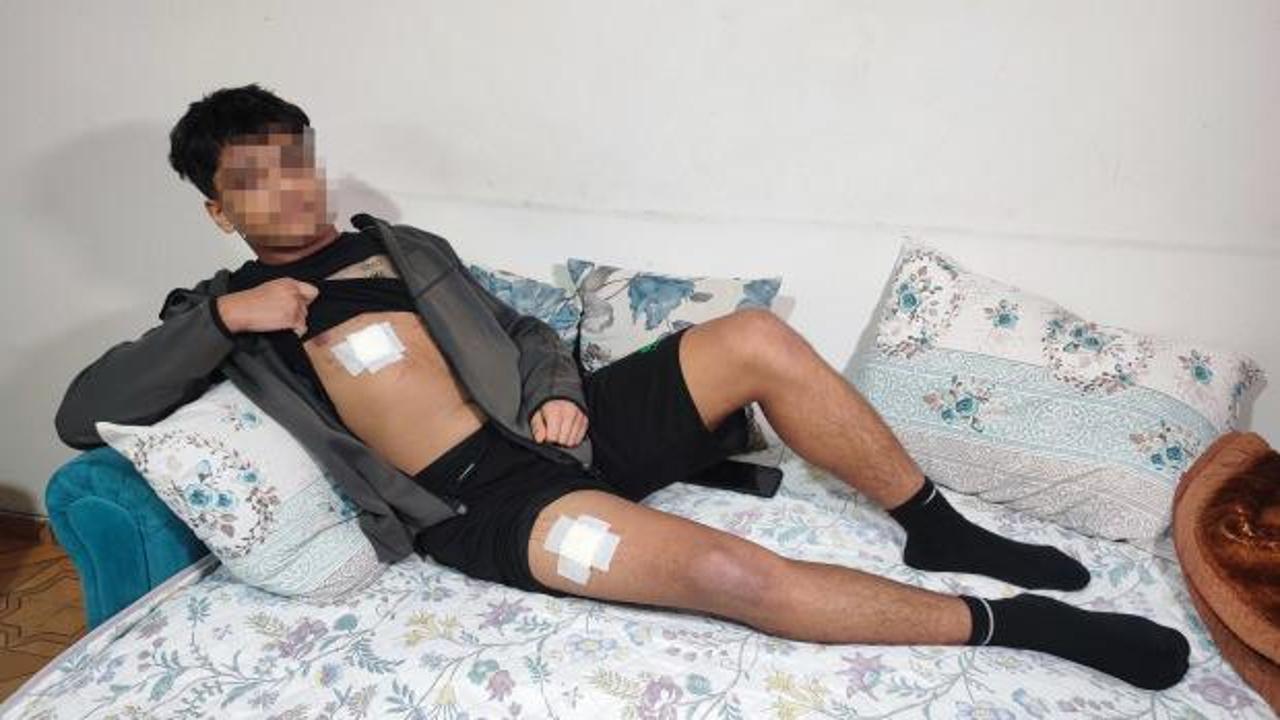 Adana'da akran vahşeti! 15 yaşındaki çocuğu önce dövdüler sonra bıçakladılar